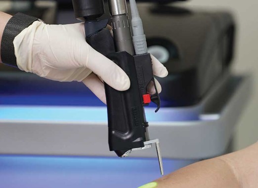 Epilation Elite IQ